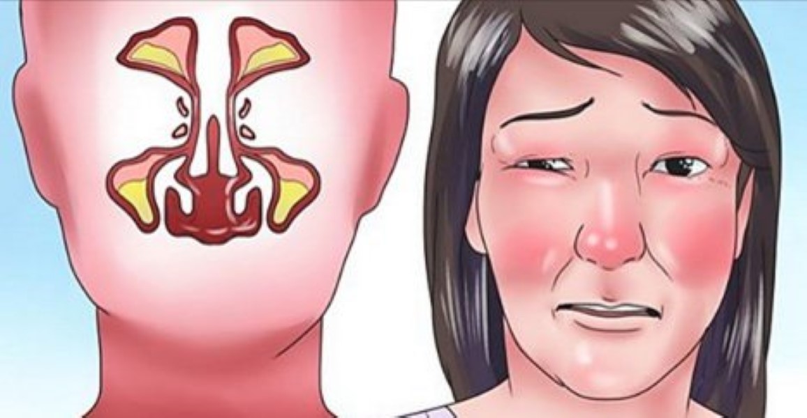 clear-your-stuffy-nose-for-good-with-this-genius-trick-in-only-2